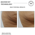 Sensifirm Anti-Cellulite Skin Tightening