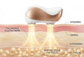 Sensifirm Pro Connected Anti-Cellulite Treatment